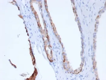 Pan Cytokeratin Recombinant Antibody Cocktail - image 1