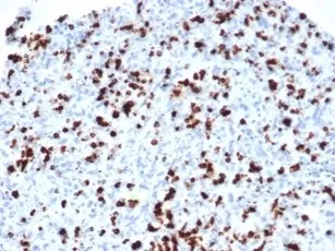 TIA-1 Recombinant Antibody / T-Cell Intracellular Antigen-1 - image 1