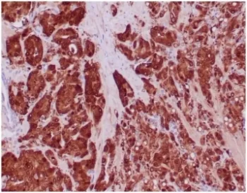 IDH1 Recombinant Antibody / Isocitrate Dehydrogenase (R132H mutant) - image 1