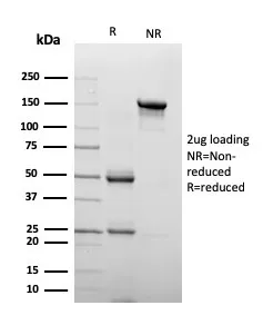 Chromogranin A Antibody - image 1