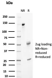 Clusterin Antibody / Apolipoprotein J / APO-J - image 1