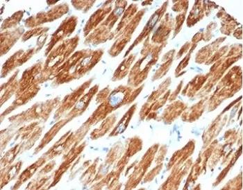 Desmin Antibody - image 1