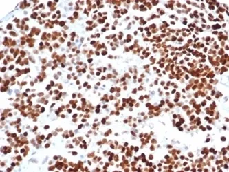 p53 Recombinant Antibody / TP53 - image 1