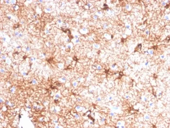 GFAP Antibody / Glial Fibrillary Acidic Protein - image 1