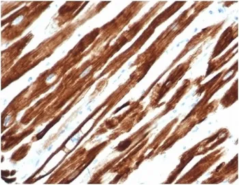 Desmin Recombinant Antibody - image 1