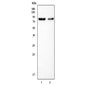 ATR Antibody / Anthrax toxin receptor / TEM8 - image 1