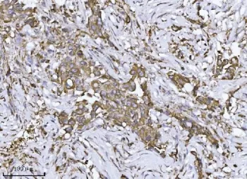 SCA2 Antibody / ATXN2 / Ataxin-2 - image 1