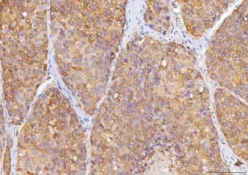 Sorbitol Dehydrogenase Antibody - image 1