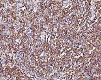 Alpha Enolase Antibody / ENO1 / Enolase 1 - image 1