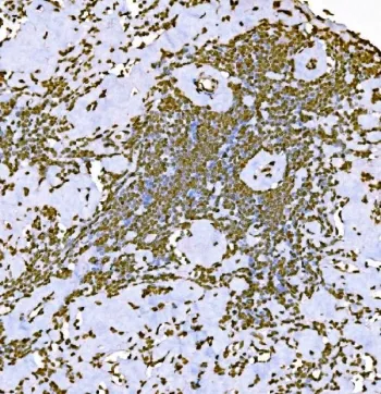 Histone H1.0 Antibody / H1F0 - image 1