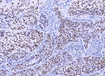 MSH2 Antibody - image 1