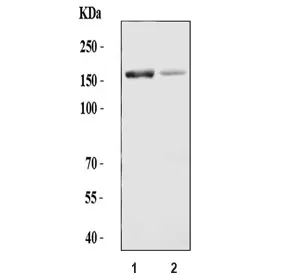 ADAMTS13 Antibody - image 1