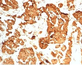 HCG-beta Recombinant Antibody - image 1