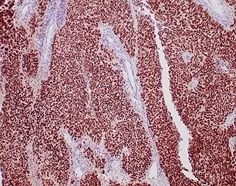 GATA3 Recombinant Antibody - image 1
