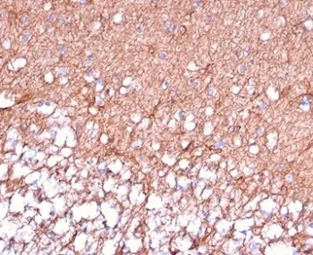 GFAP Antibody / Glial Fibrillary Acidic Protein - image 1