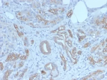 Golgi Recombinant Antibody / GLG1 - image 1