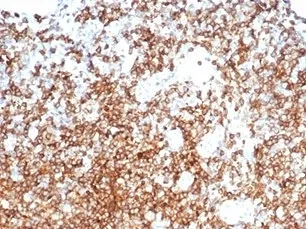 CD13 Antibody / ANPEP - image 1