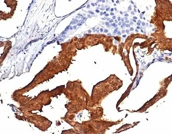 IDH1 Recombinant Antibody / Isocitrate Dehydrogenase (R132H mutant) - image 1