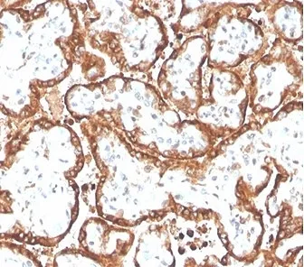 HCG-beta Recombinant Antibody - image 1