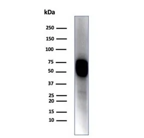 Cytokeratin 14 Antibody / CK14 / KRT14 - image 1