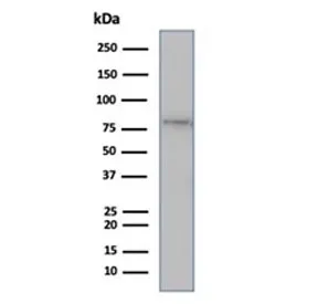 MLH1 Recombinant Antibody / MutL Homolog 1 - image 1