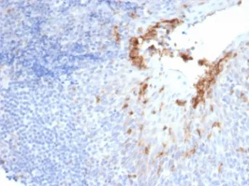 CD10 Recombinant Antibody / Neprilysin - image 1