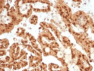 STAT6 Recombinant Antibody - image 1
