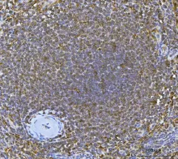 Interferon regulatory factor 7 Antibody / IRF7 - image 1