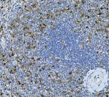 Interleukin 17A Antibody - image 1