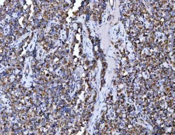 ACO2 Antibody / Aconitase 2 - image 1