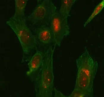 Glycogen synthase kinase-3 beta Antibody / GSK3B - image 1