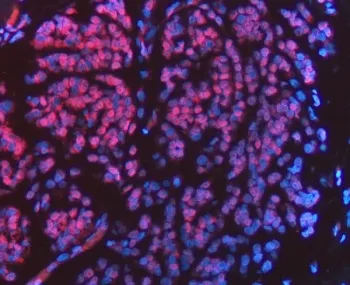 FIP1L1 Antibody / Pre-mRNA 3'-end-processing factor FIP1 - image 1