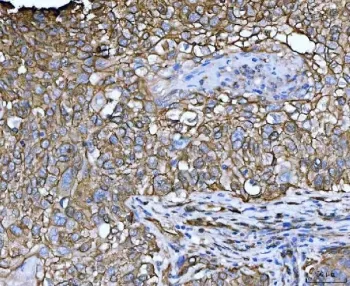 LIMA1 Antibody / EPLIN - image 1