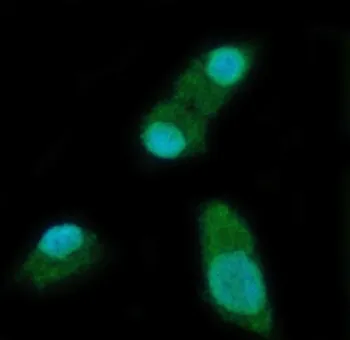 YTH domain-containing protein 2 Antibody / YTHDC2 - image 1