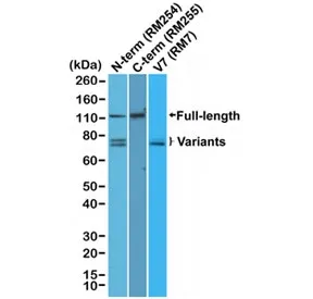 Androgen Receptor Recombinant Antibody / C-terminus - image 1