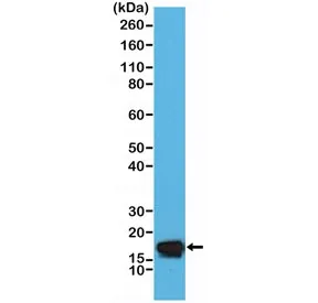 STMN1 Recombinant Antibody / Stathmin - image 1