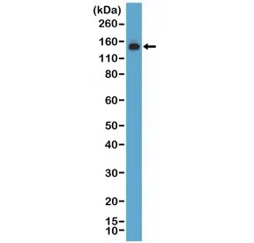MSH6 Recombinant Antibody - image 1
