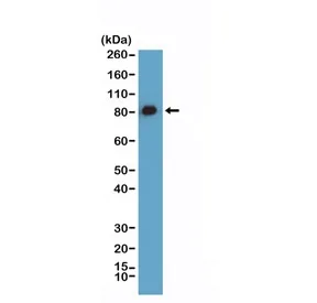 Caldesmon Recombinant Antibody / CALD1 / CAD - image 1