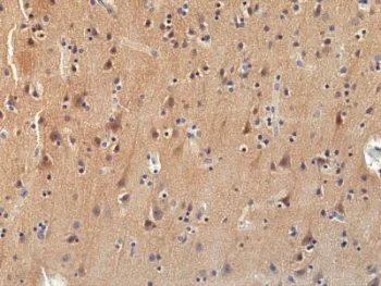 Pan TRK Recombinant Antibody / TrkA/B/C - image 1