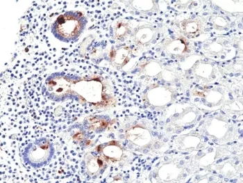 Helicobacter pylori Recombinant Antibody - image 1