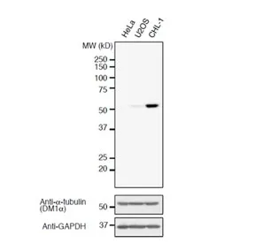 Detyrosinated Alpha Tubulin Recombinant Antibody - image 1