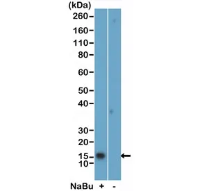H2BK5ac Recombinant Antibody / Acetyl-Histone H2B Lysine 5 - image 1
