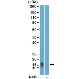 H2BK11ac Recombinant Antibody / Acetyl-Histone H2B Lysine 11 - image 1