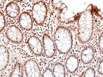 Phosphorylated JNK Recombinant Antibody / pThr183/pTyr185 - image 1