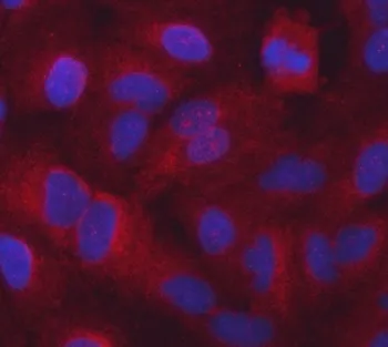 SARS1 Antibody / Seryl-tRNA synthetase / SERS - image 1