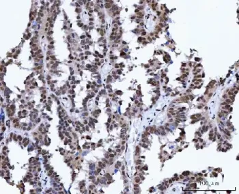 X-ray repair cross-complementing 4 Antibody / XRCC4 - image 1