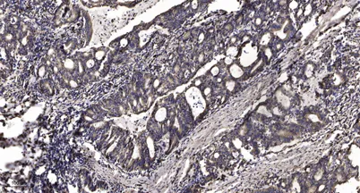 Met (Phospho Tyr1235) rabbit pAb - image 1