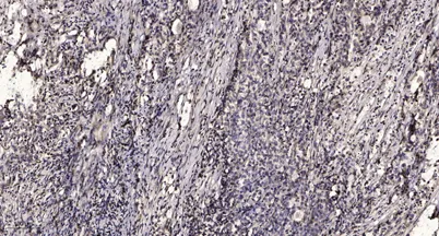 PDCD1 rabbit pAb - image 1