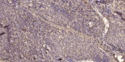 Rictor (phospho-Thr1135) rabbit pAb