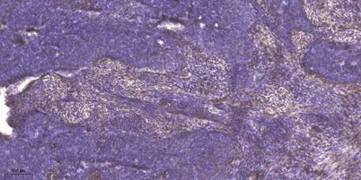 MYH-pan (Acetyl Lys1394) rabbit pAb
